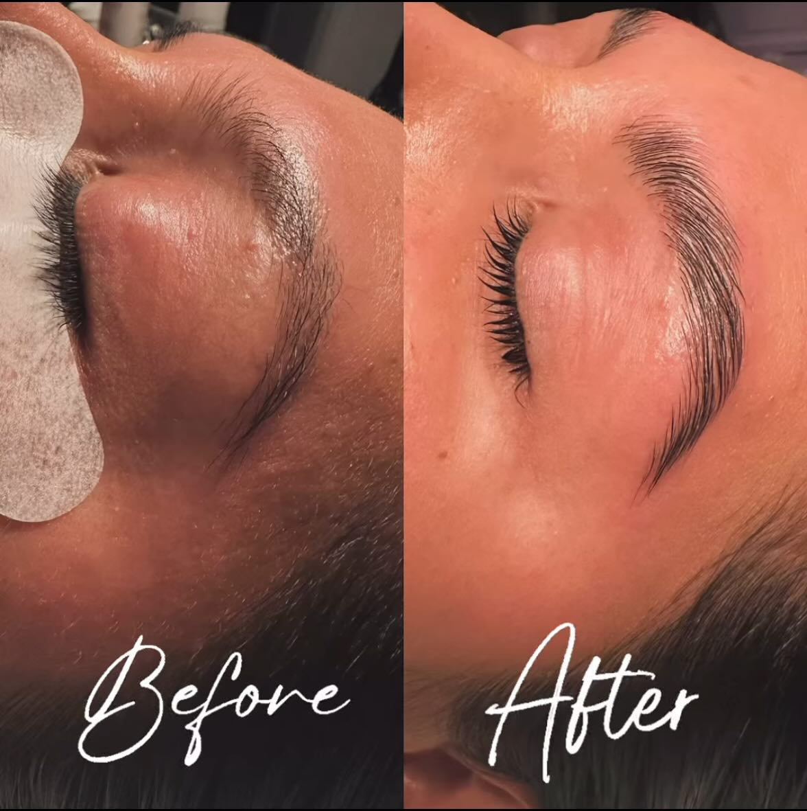 Certified Botox®, microneedling & more—discreet, effective, elegant.